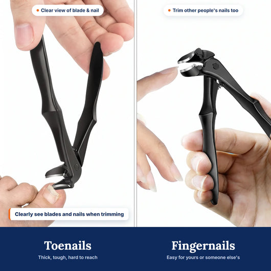 TrimReach: Toenails fingernails